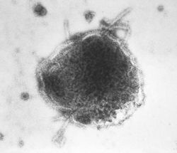 Virus Paramyxoviridae gây quai bị biến chứng viêm tinh hoàn
